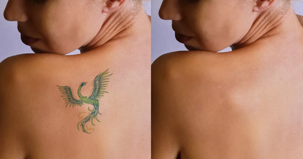 Close-up of a person gently applying lotion to a vibrant shoulder tattoo, illustrating the importance of proper care for your shoulder tattoo.